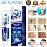 Wart Remover Ice Cream Mask